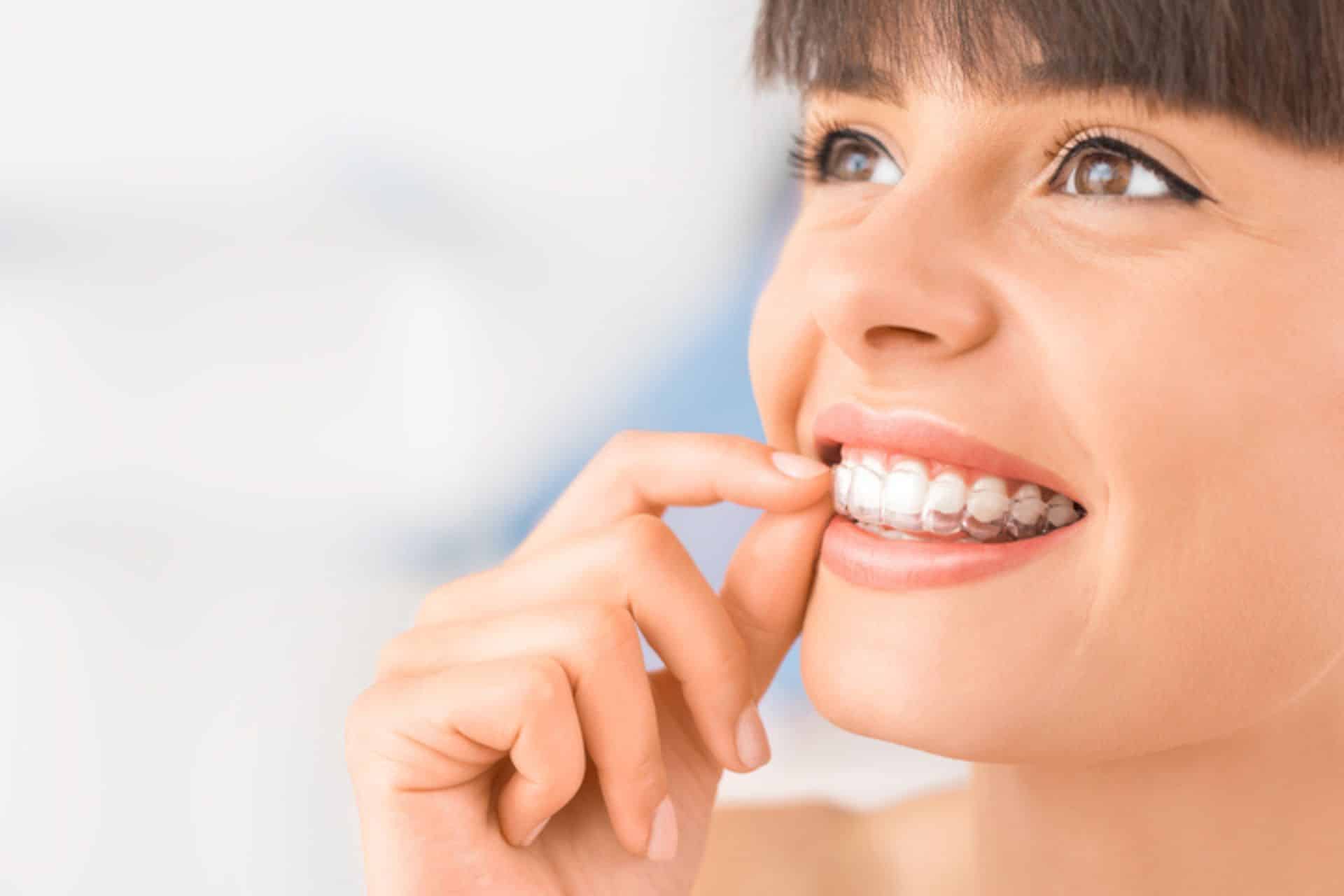 Understanding the Effectiveness of Invisalign and Braces Dr. W. Gray Grieve Orthodontics in Eugene, OR
