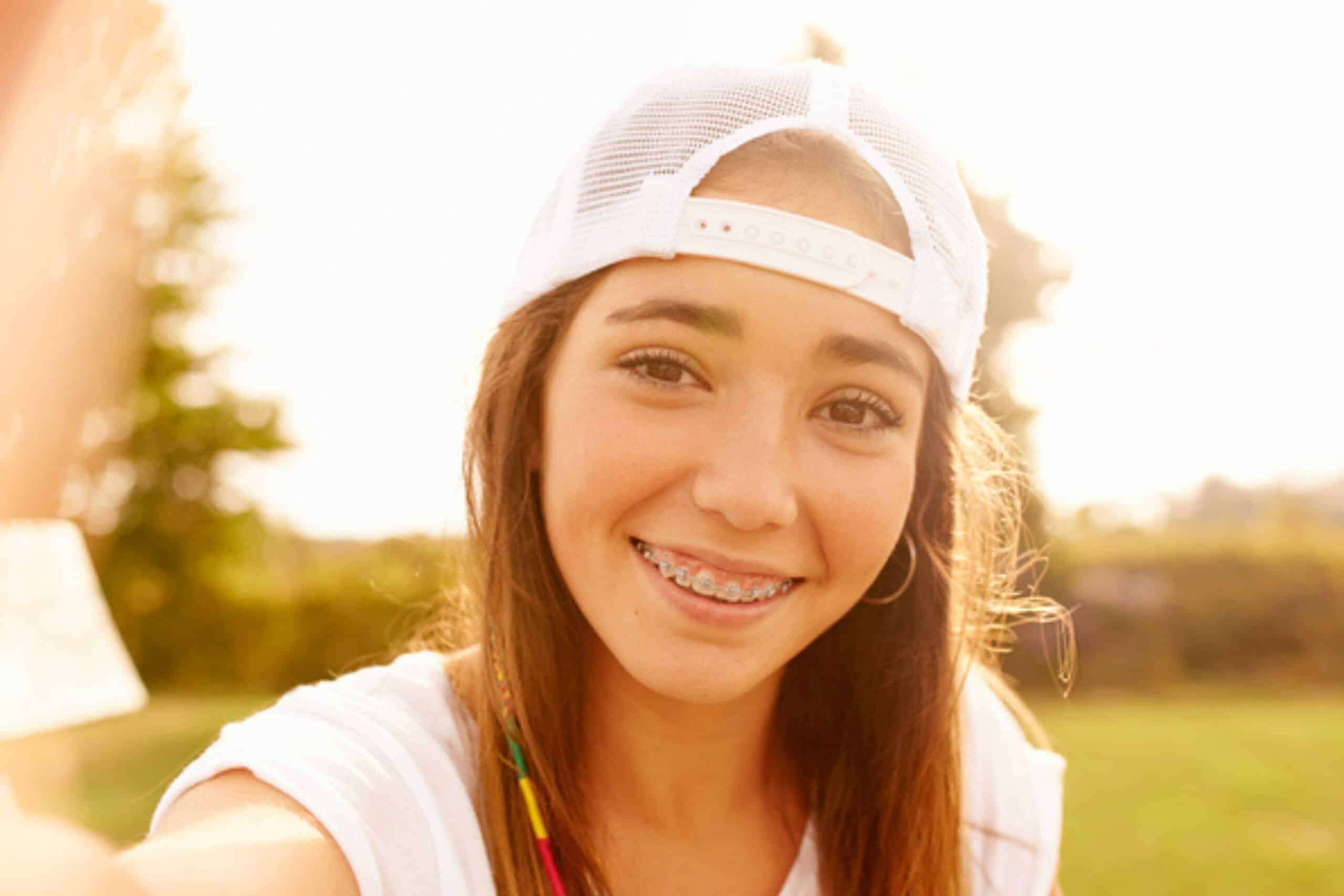 Can You Whiten Teeth While Wearing Braces in Eugene, OR? Dr. W. Gray Grieve Orthodontics